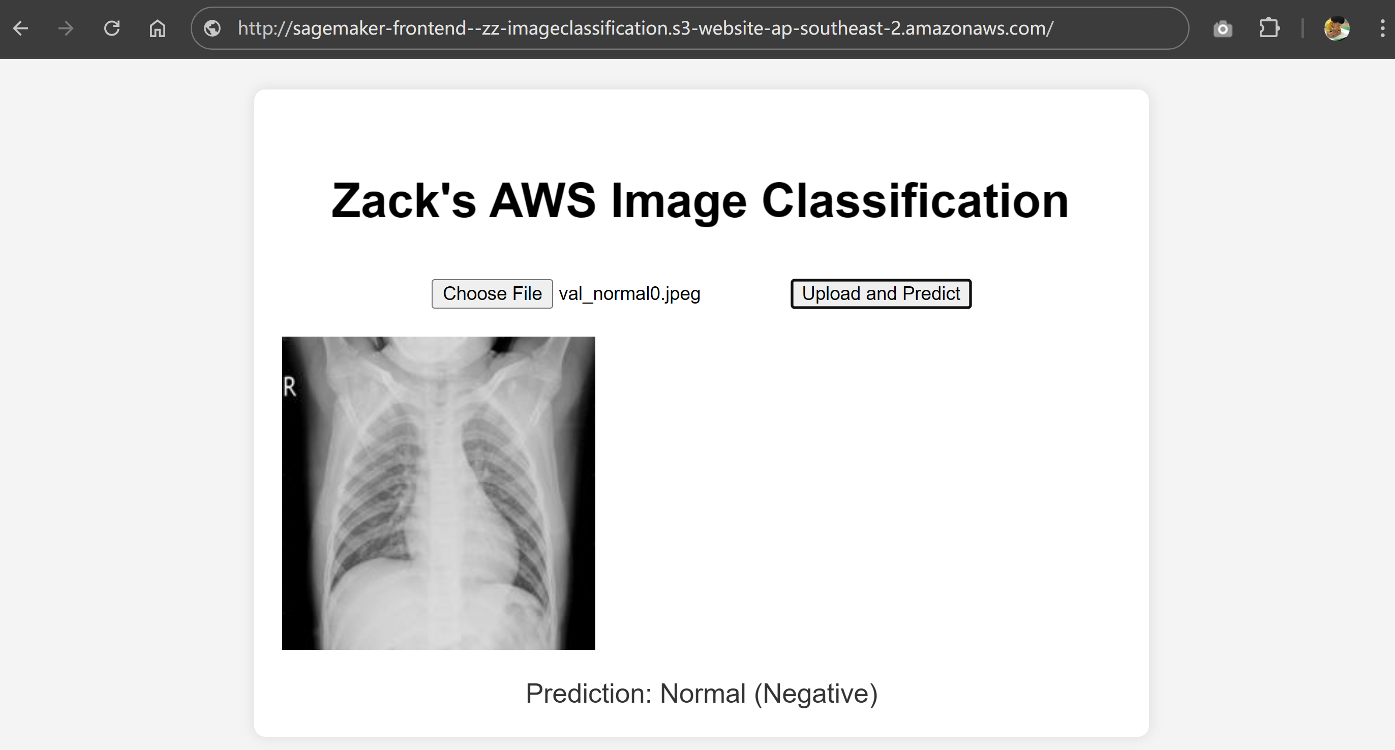 image tooltip here