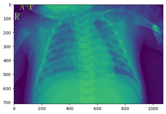 image tooltip here